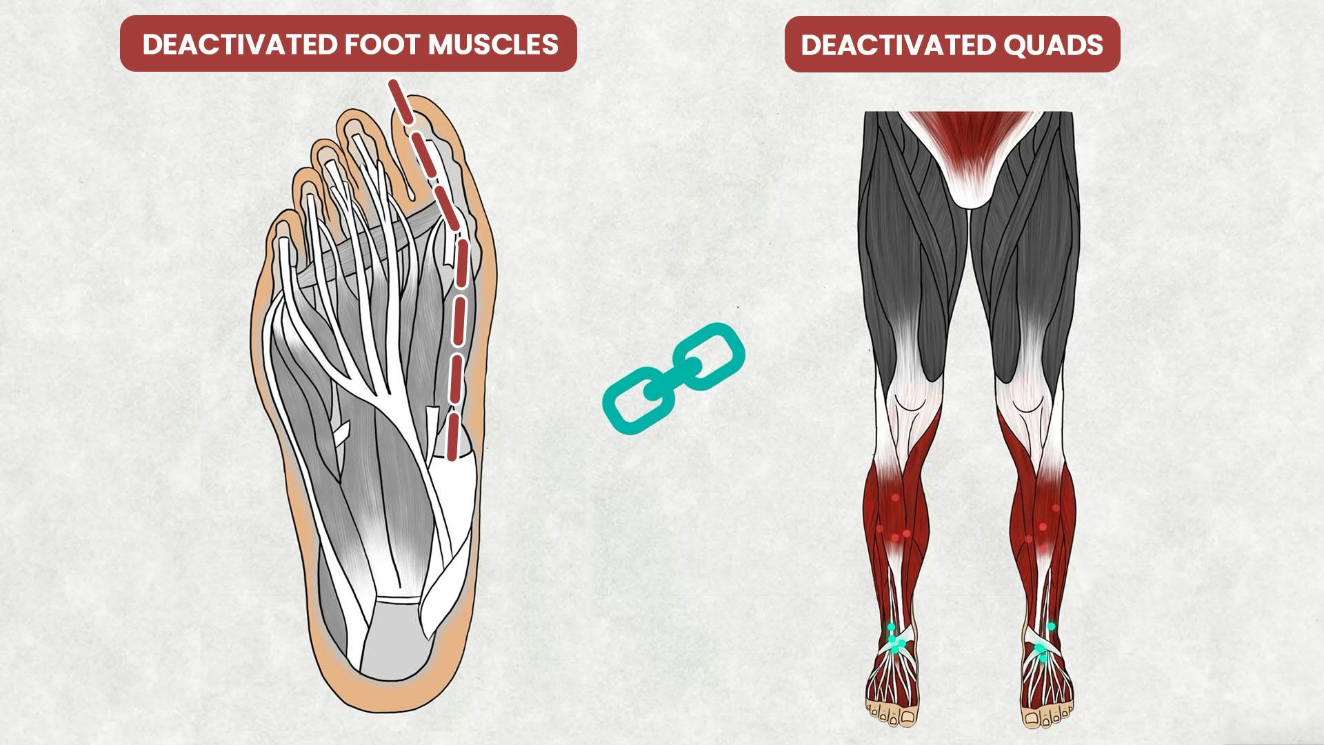 Deactivated Foot Muscles Causes Quad Deactivation