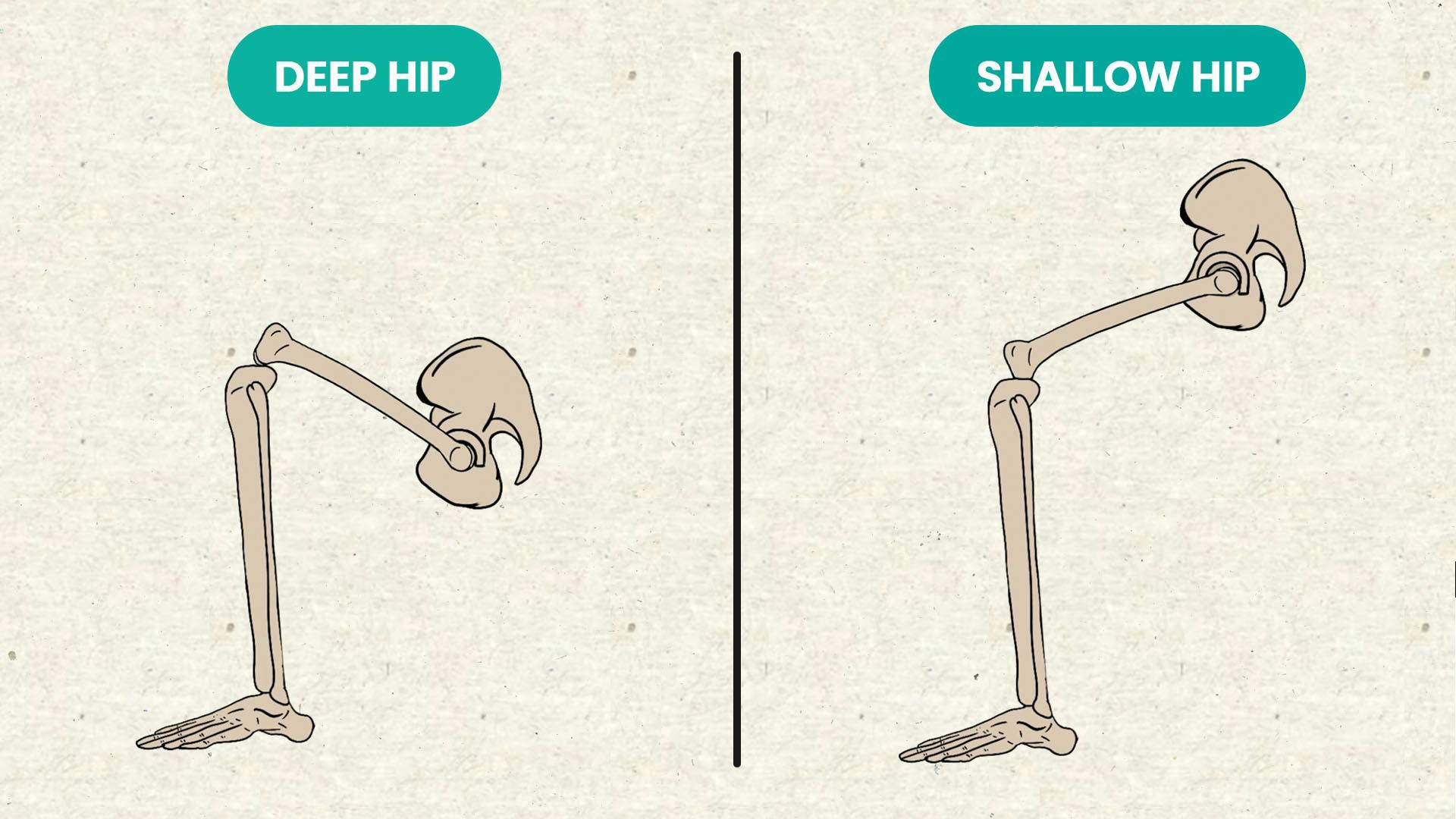 Deep Vs Shallow Hip Joints