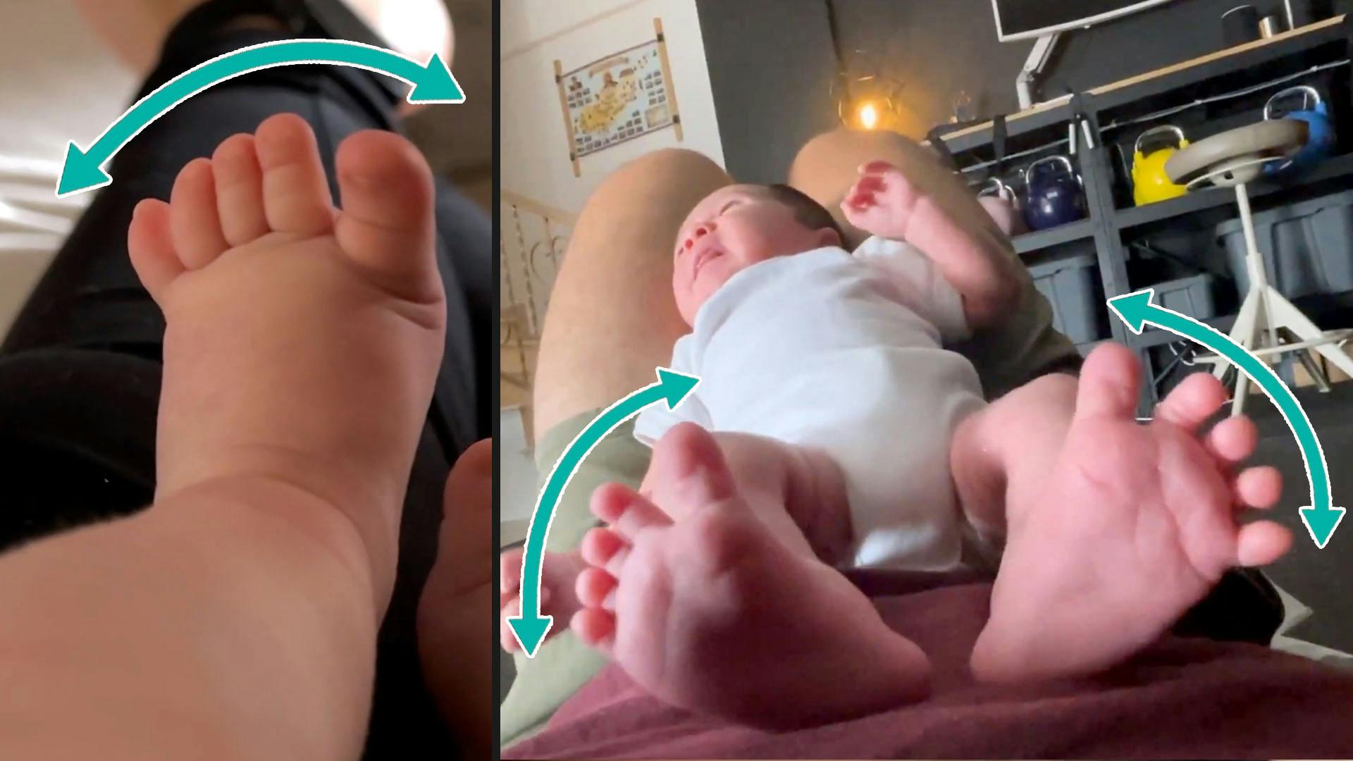 Toe Splay in Newborn Babies
