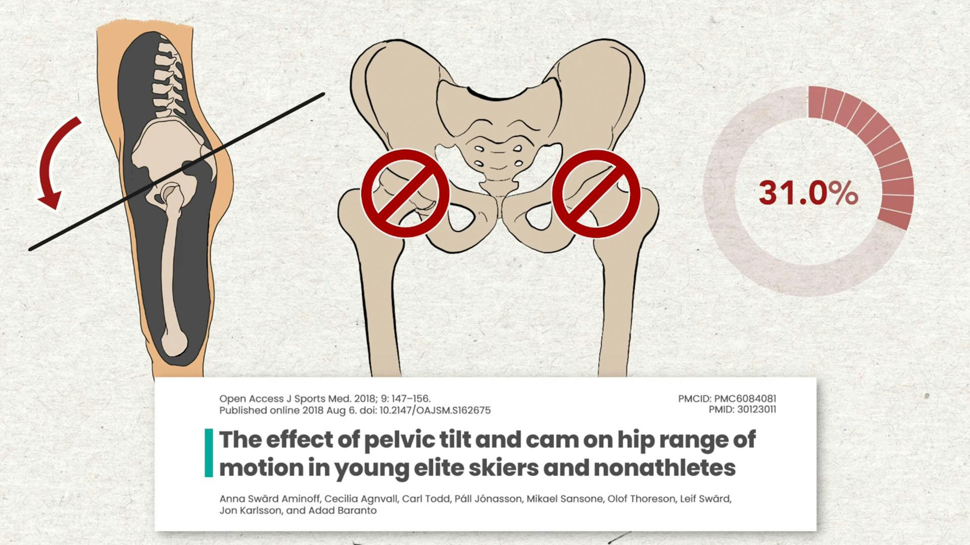 Anterior Pelvic Tilt Decreases Hip Mobility