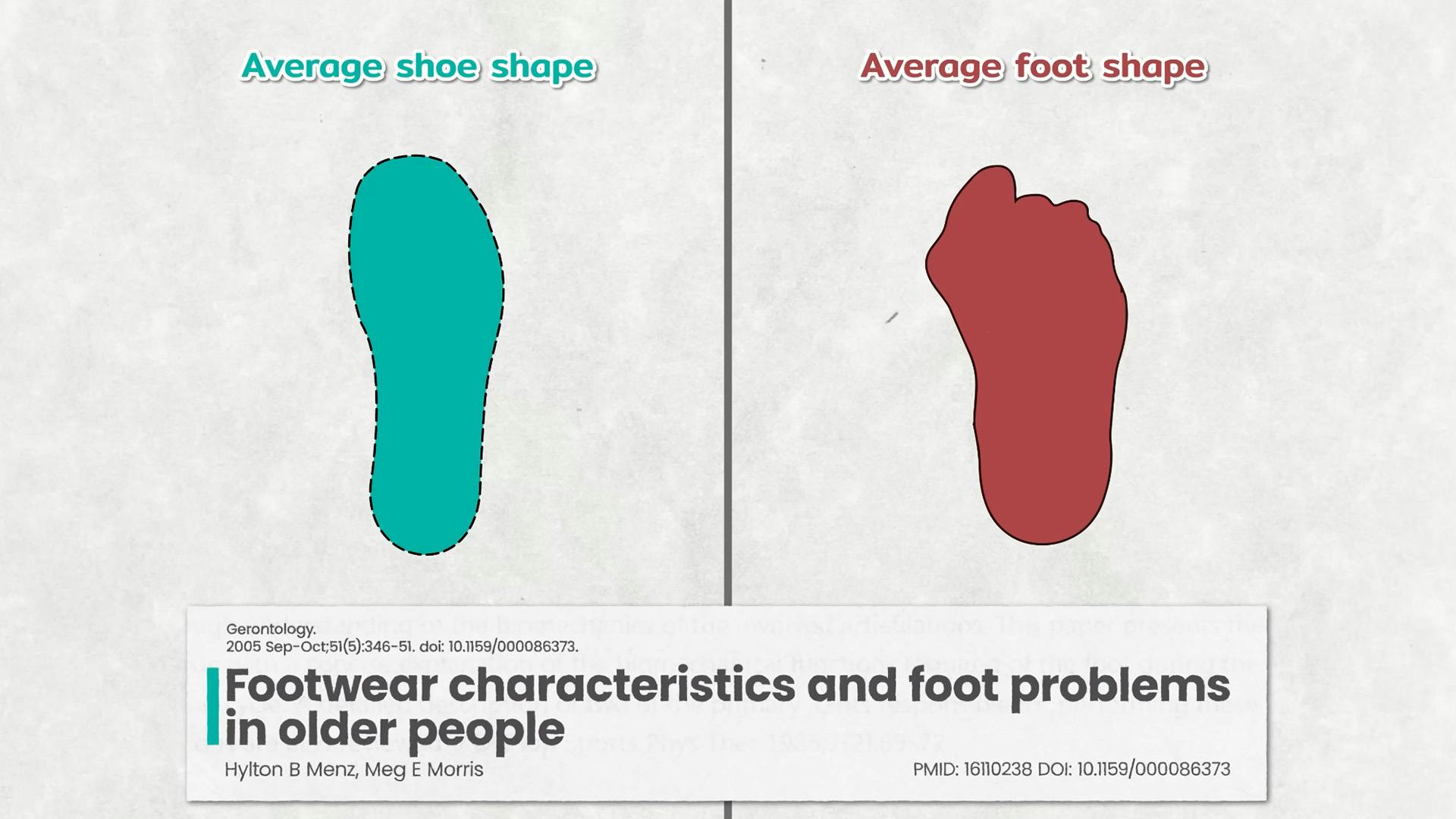 Average Foot Shape Vs Shoe Shape in 62 to 96 Year Olds 
